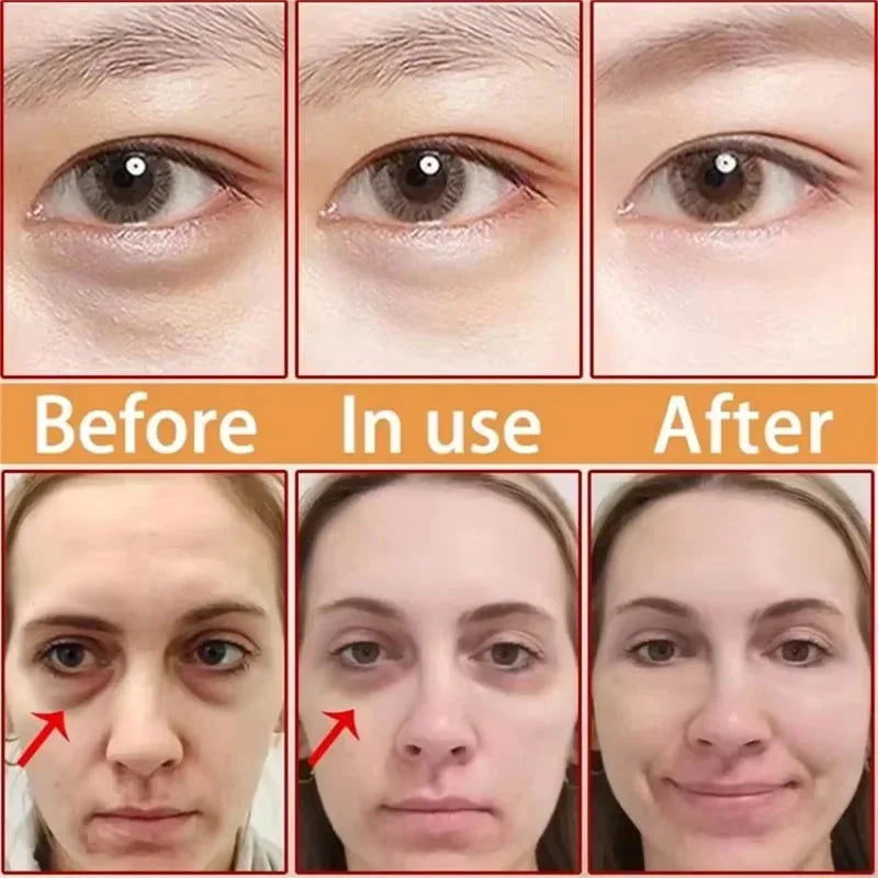 Instant Eye Bag Removal Cream Collagen Anti-Wrinkle Firming Skin Fade Fine Lines Anti Dark Circle Puffiness Brighten Eye Care