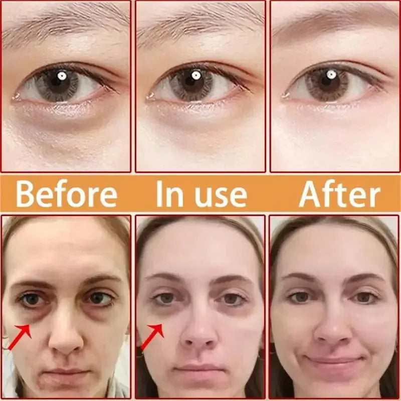 Instant Eye Bag Removal Cream Collagen Anti-Wrinkle Firming Skin Fade Fine Lines Anti Dark Circle Puffiness Brighten Eye Care