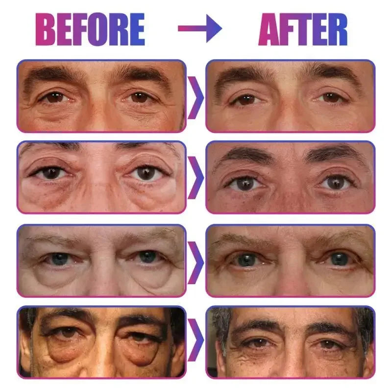 Instant Eye Bag Removal Cream Collagen Anti-Wrinkle Firming Skin Fade Fine Lines Anti Dark Circle Puffiness Brighten Eye Care