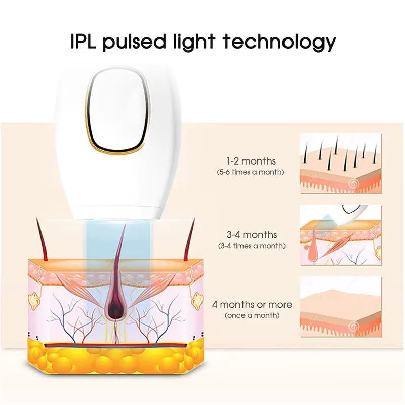 Ipl hair removal laser epilator fast flash epilator painless permanent epilator body treatment for women